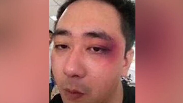 Vương Tự Kiện từng bị vợ là nhà vô địch tán đả bạo hành gia đình liên tục tát, tổng cộng 500 cái tát