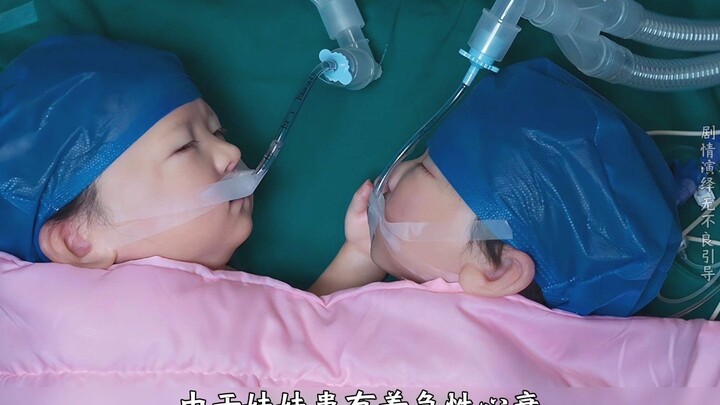 A young doctor performed a separation surgery, but the outcome shocked everyone!