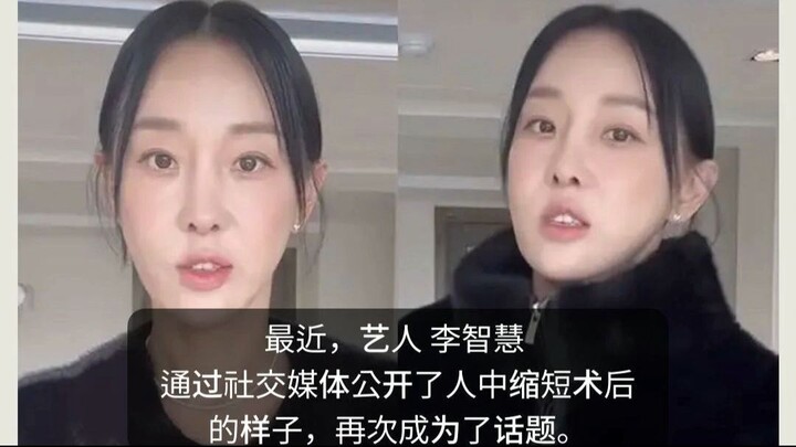 李智慧缩人中手术后引热议！为什么你的“人中”越变越长？