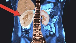 What grew inside her body actually "didn't exist" medically?
