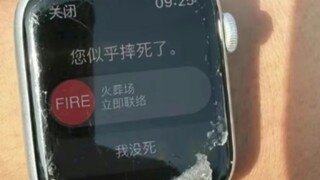 لقد سقطت فقط، لا داعي للتعامل مع الأمر بهذه الطريقة