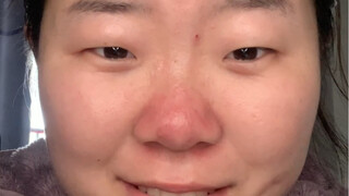 Phát hiện một loại miếng dán tạo mí mắt hai bên tàng hình