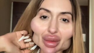 有着夸张“整容脸”的36岁网红Anastasia Pokreshchuk，是这样回应网友质疑的