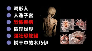 【Edisi Kedua】Kisah Unik tentang Orang: Manusia Garam dari Tahun 1700