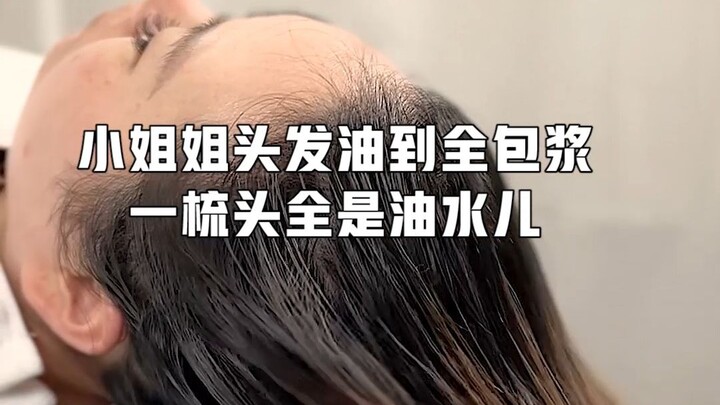 สาวน้อยผมมันจนเคลือบไปทั้งศีรษะ แค่หวีผมครั้งเดียวก็มีแต่น้ำมันไหลออกมาเลย