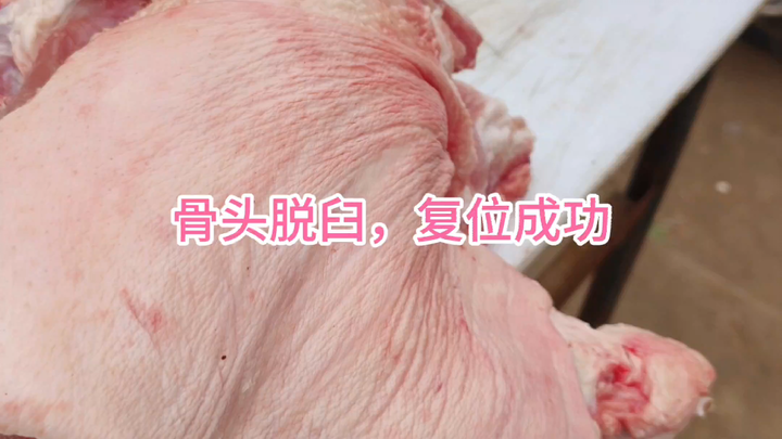 Bone dislocation successfully reduced!