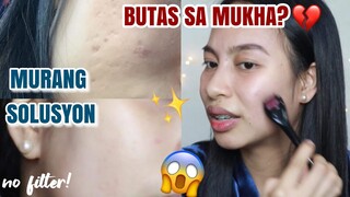 MURANG SOLUSYON SA MGA BUTAS SA MUKHA! MICRO NEEDLE ROLLER EXRERIENCE | Princess Pagaduan