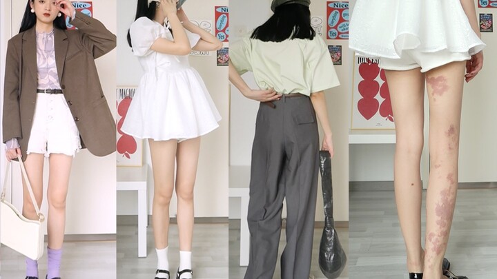 The Freestyle Leg-Showing Look of a Girl with a Birthmark | Spring Outfits That Maximize Height and 