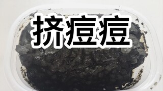 【不密恐 很舒爽】 暖宝宝史莱姆里养水宝宝 就可以玩挤痘痘了