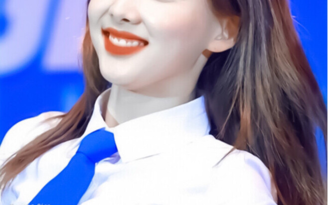 “Even being able to walk was already a blessing! But because of my dream to become an idol, I ended 