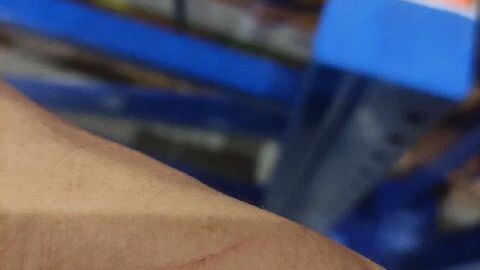 battle scar's