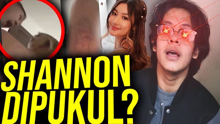 SHANNON WONG DIPUKUL ORANG TUA !! BOHONG ATAU BENERAN ??