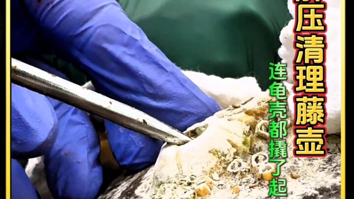 Hôm nay không bình luận, xem trọn bộ quá trình cạo hà một cách nhập vai