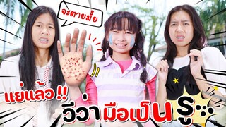 เกิดอะไรขึ้น!! น้องวีว่า มือเป็นรู | WiwaWawow TV