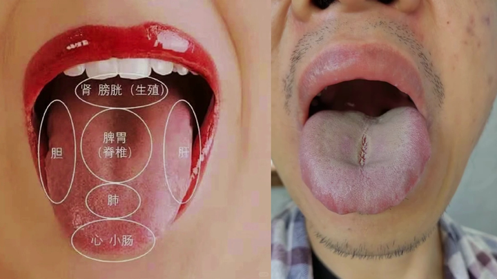 Giảng giải về chẩn đoán bằng lưỡi, chiếc xe của bạn chạy có ổn không?