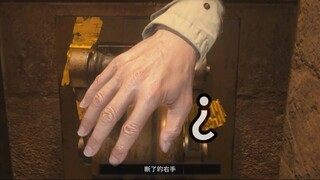 胳膊不小心断了怎么办？倒瓶洗手液就好