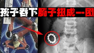 【磁力球杀手】设计缺陷打穿孩子肠道，家长们一定要警惕的玩具