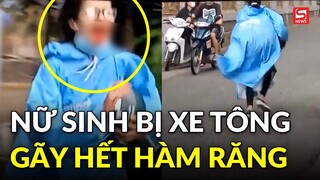 Nữ sinh bị tông xe mất hết cả hàm răng, hoảng loạn chạy theo giữ người gây tai nạn ở lại