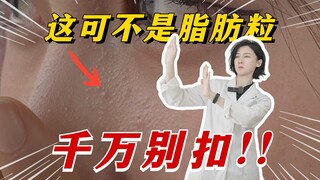 这可不是脂肪粒，千万别扣！