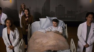 【Yu Ge】Tumor raksasa yang tumbuh dari beberapa gram hingga seratus jin, bagaimana cara menghilangkan