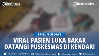 Viral Pasien Luka Bakar Datangi Puskesmas Seorang Diri Naik Motor di Kendari Sulawesi Tenggara