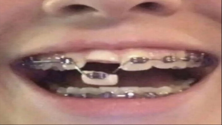 【คลิปฮาสุดหินจากต่างประเทศ #285】