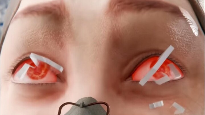 Thủy tinh thể nhân tạo ra đời như thế nào?