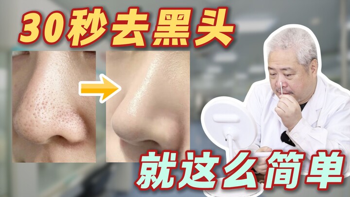 【Khoa học phổ biến】Chúc mừng bạn! Vô tình phát hiện mẹo hay loại bỏ mụn đầu đen một cách khoa học