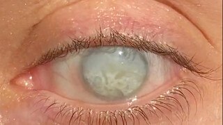 Người Nga giống như Bạch Nhãn của gia tộc Hyuga trong Naruto