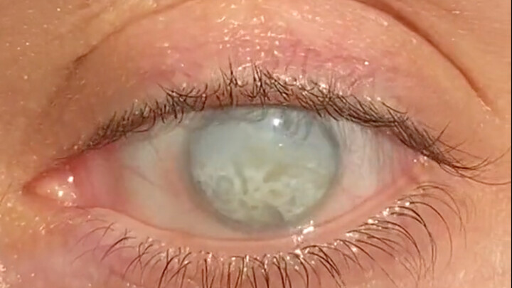 Russians are like the Byakugan of the Hyuga clan in Naruto.