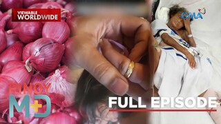 Babae, nasagasaan ng motor; Singsing na ‘di matanggal, ano ang solusyon? (Full Episode) | Pinoy MD