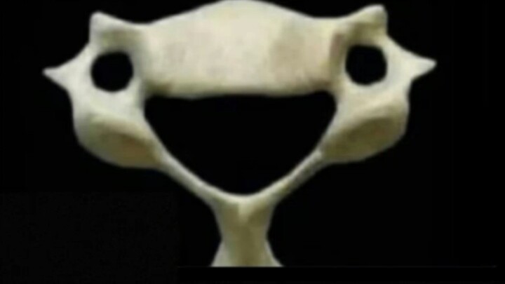 This is your sixth cervical vertebra; it helps you bear the daily strain, yet it remains cheerful ev