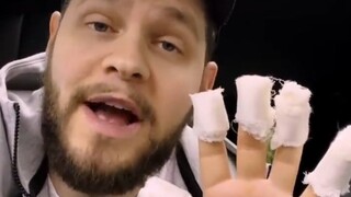 قام الشاب بنشر مقطع فيديو ليشرح كيف اختفت بصمات أصابع يده بأكملها دفعة واحدة