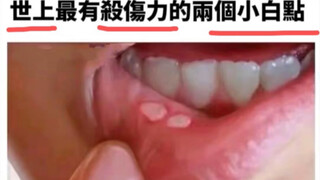 世上最有杀伤力的两个小白点