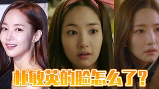 What happened to Park Min-young's face?