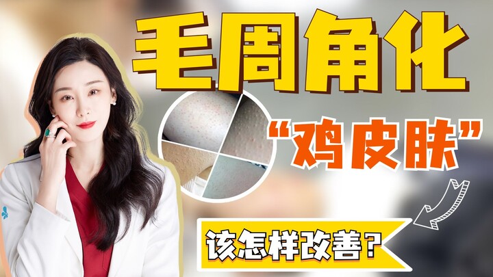 Bagaimana cara memperbaiki keratosis pilaris?