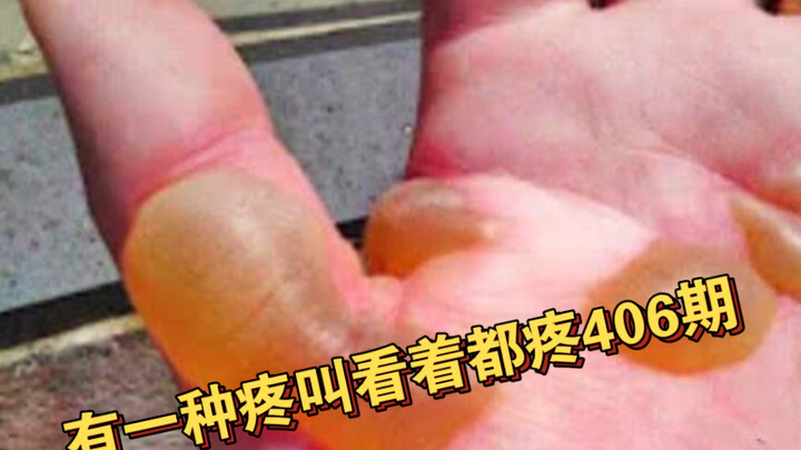 There's a kind of pain that hurts just to watch—Episode 406