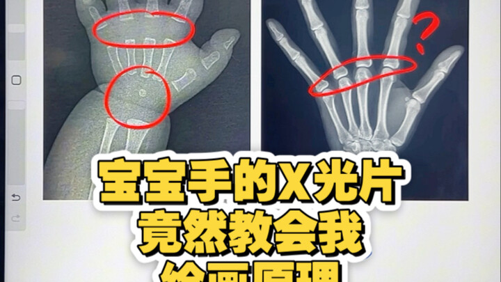 Ternyata foto rontgen tangan bayi justru mengajarkan saya prinsip dasar melukis!