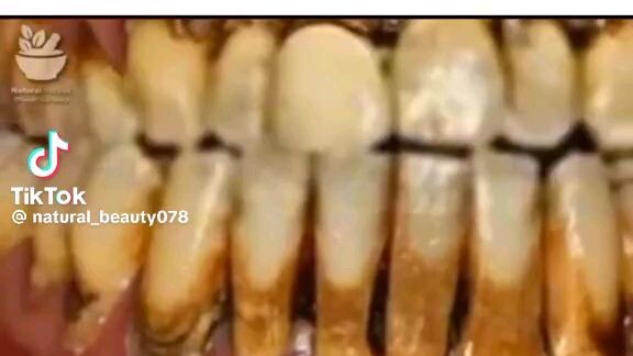 How to make your teeth white?