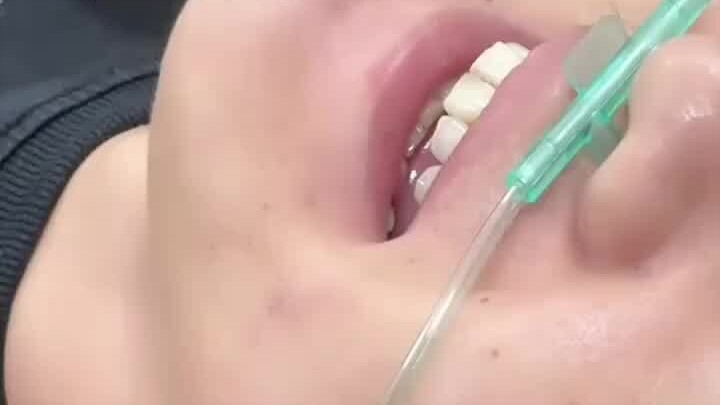 Man under general anesthesia challenges how long he can hold on—counting away, he starts rambling, t