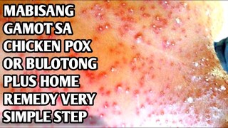 EFFECTIVE WAY TO CURE CHICKEN POX OR BULUTONG PLUS  EASY HOME REMEDY+ TAMANG GAMOT