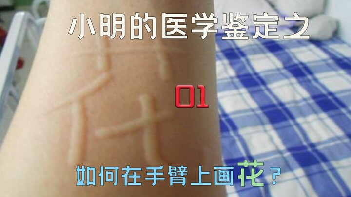 《医学鉴定》网络热门医学视频鉴定01
