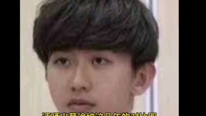 #Cai Xukun Exposed for Spending 16,000 on Plastic Surgery# #Cai Xukun# Cai Xukun’s Plastic Surgery –