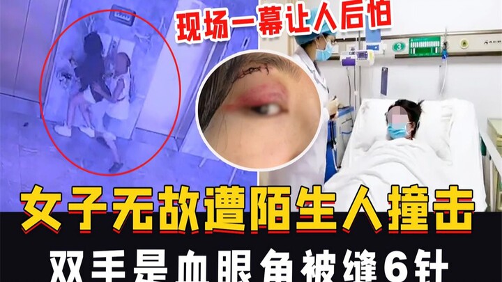 Cô gái bị người lạ đâm ngã không rõ lý do, hai tay đầy máu, khóe mắt phải khâu 6 mũi – cảnh tượng hi