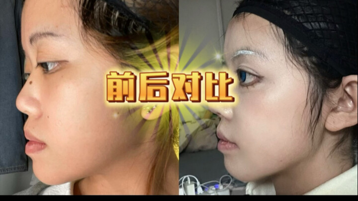 ยังไม่สวยเท่าเมื่อก่อนใช่ไหม ถ้างั้นที่ฉันพยายามมาทั้งหมดก็สูญเปล่า สุดท้ายเงินก็เสียไปฟรีๆ...