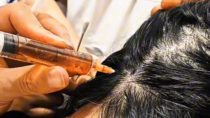 Deadly Traditional Chinese Medicine: Herbal Injections