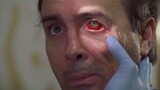 [เฒ่าเปา] ดวงตาของชายคนหนึ่งแดงก่ำและร่างกายของเขาเต็มไปด้วยรอยฟกช้ำ หมอทำอะไรไม่ถูก แต่เขารักษาตัวเ