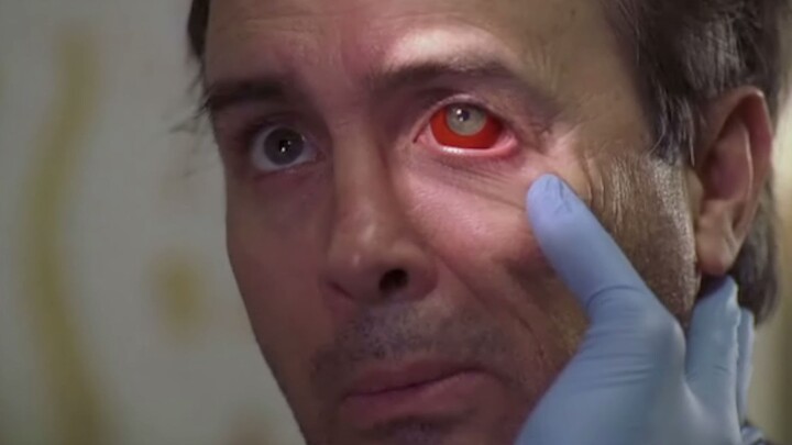 [Pao Tua] Mata seorang pria merah dan tubuhnya dipenuhi memar. Dokter tidak berdaya, tetapi dia meny