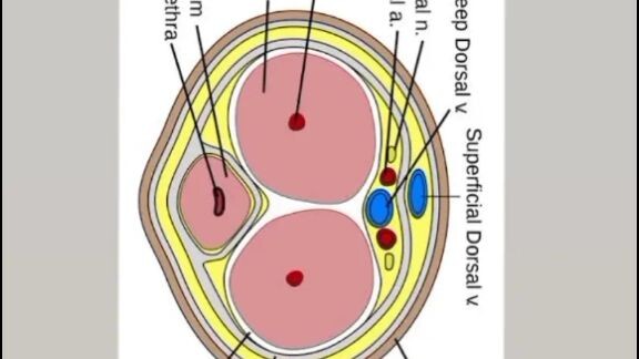 transverse