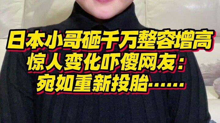 Pria Jepang bertubuh mungil 1,5 meter habiskan 16 juta untuk serangkaian operasi plastik demi menamb